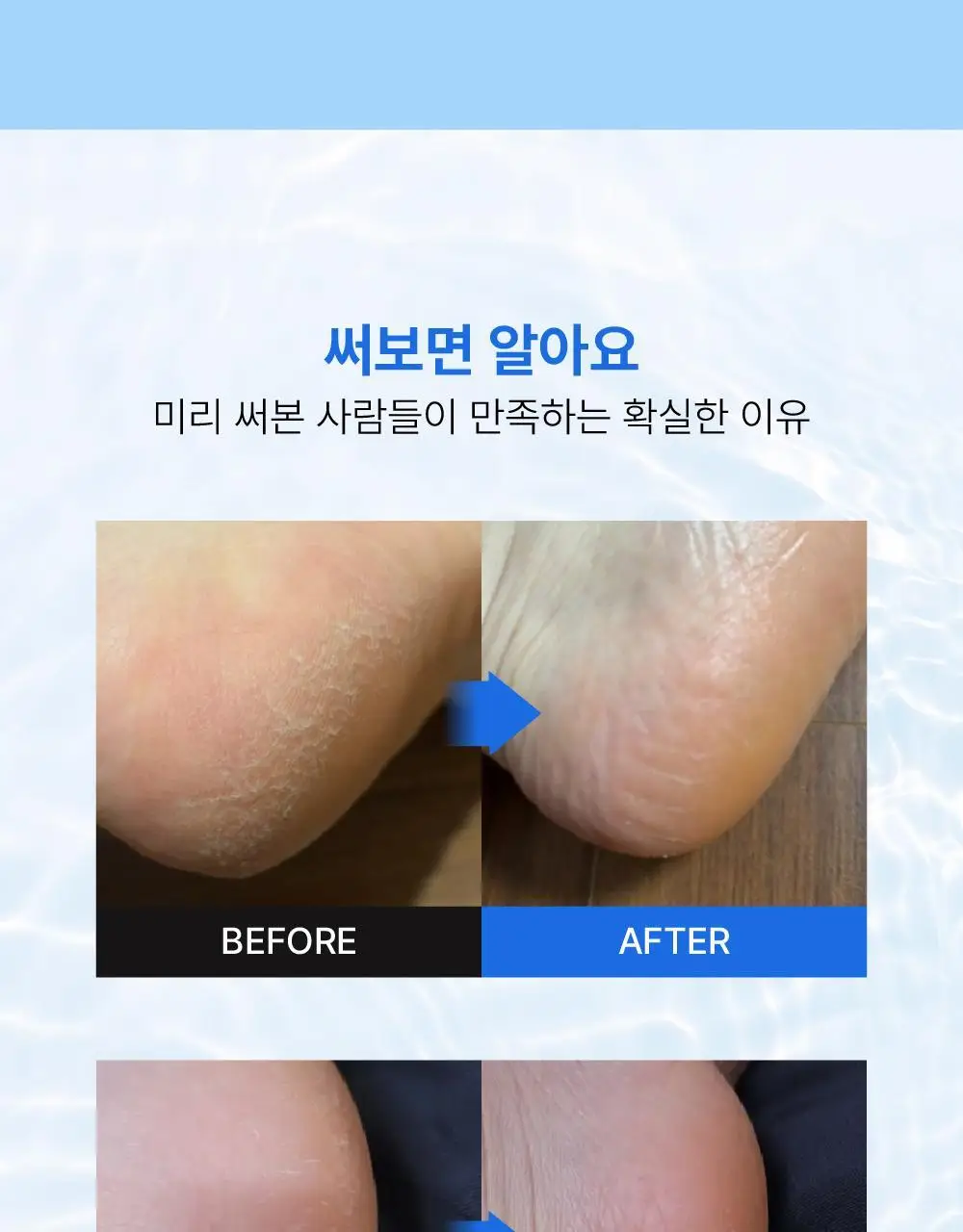 [풋케어] 라보타치 풋 모이스트 패치 4매입 상세페이지 7
